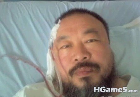 艾未未被打.jpg